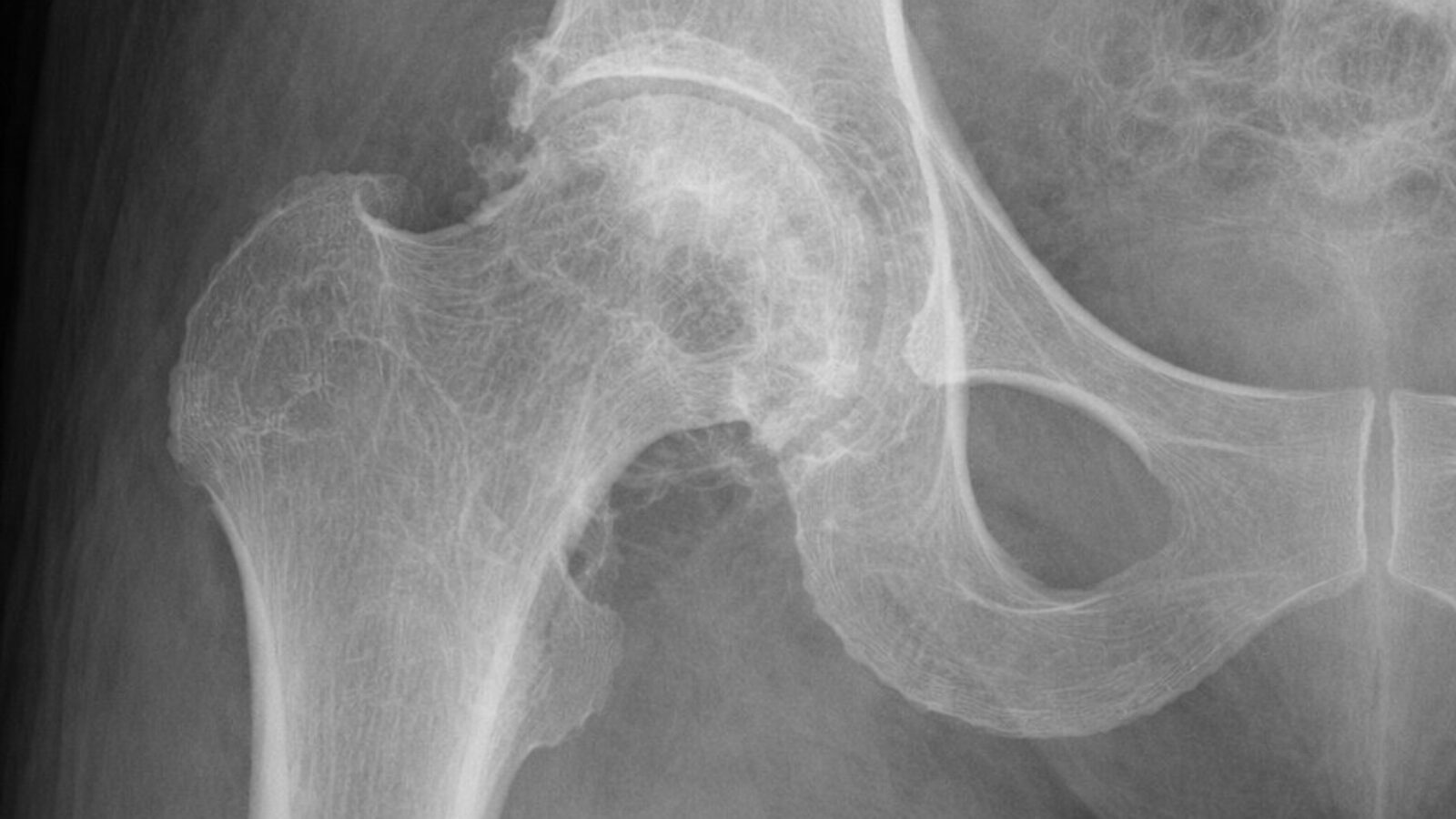 (Spoiler alert) I think it's an AI-generated X-ray of a hip bone. Very convincing.